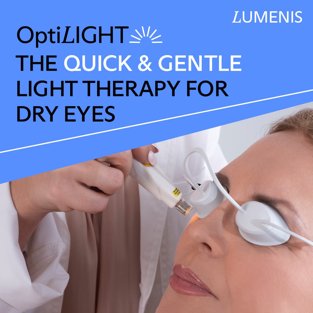 Introducing OptiLight IPL: A Revolutionary Treatment for Dry Eye
